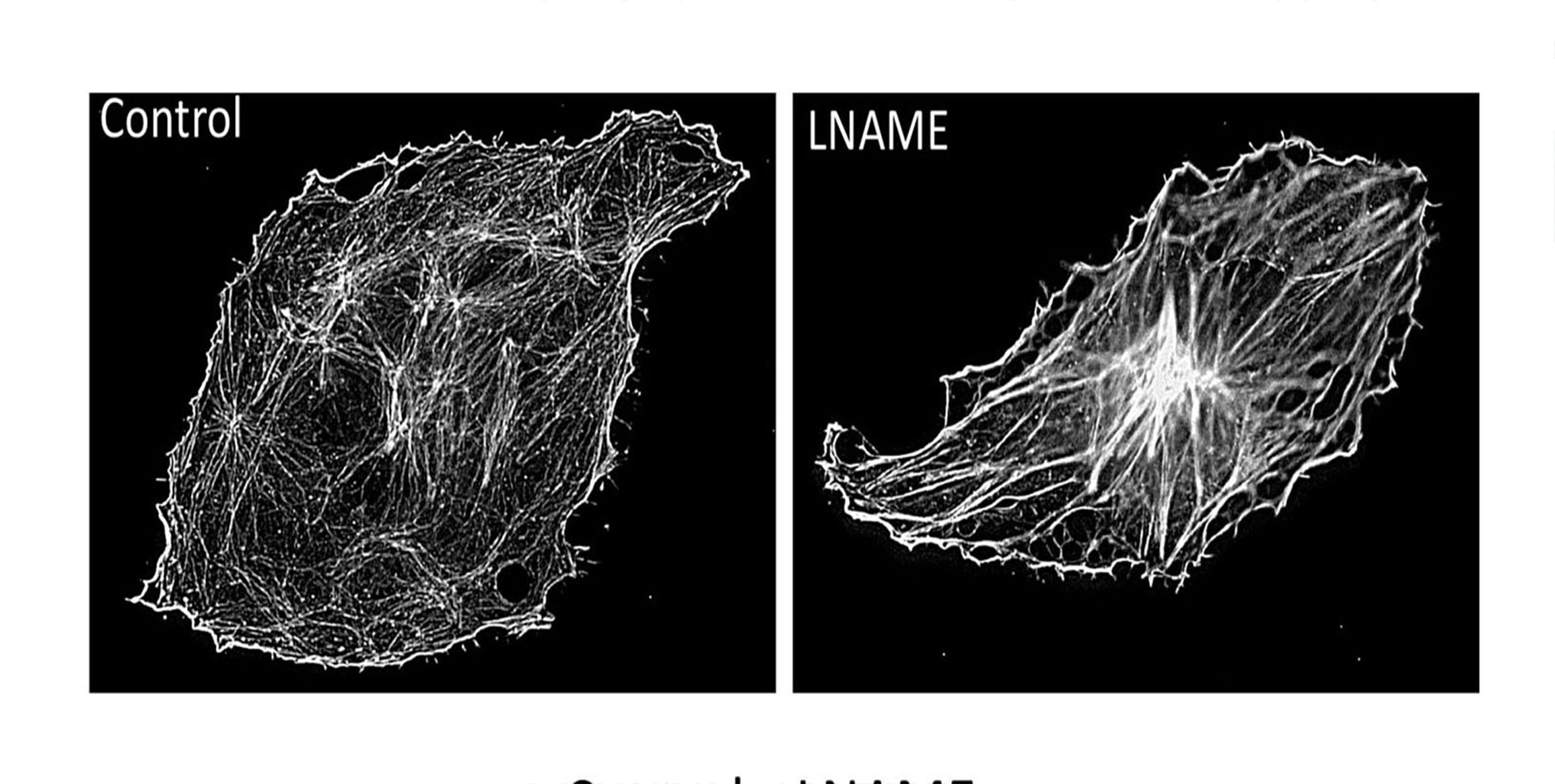 Reduced Brain Cortex Angiogenesis in the Offspring of the Preeclampsia-Like Syndrome